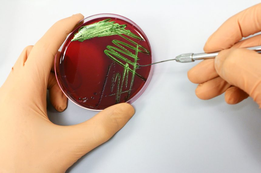 Culturing on an agar plate.
